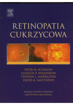 Retinopatia cukrzycowa