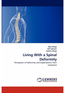 Living With a Spinal Deformity