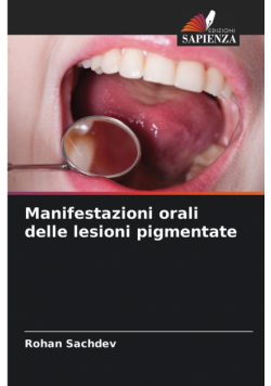 Manifestazioni orali delle lesioni pigmentate