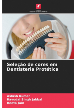 Seleção de cores em Dentisteria Protética