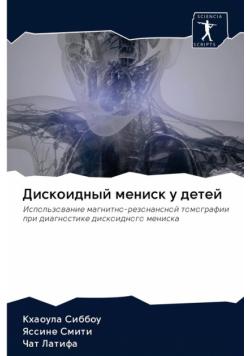Дискоидный мениск у детей