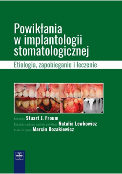 Powikłania w implantologii stomatologicznej.