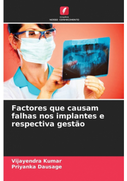 Factores que causam falhas nos implantes e respectiva gestão