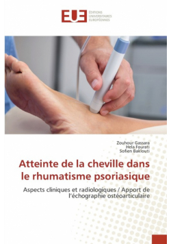 Atteinte de la cheville dans le rhumatisme psoriasique