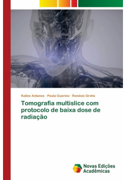 Tomografia multislice com protocolo de baixa dose de radiação