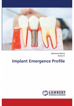 Implant Emergence Profile