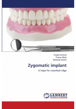 Zygomatic implant