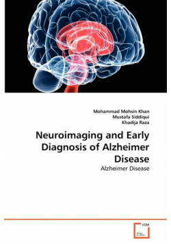 Neuroimaging and Early Diagnosis of Alzheimer Disease