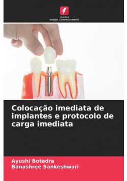Colocação imediata de implantes e protocolo de carga imediata