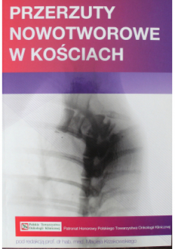 Przerzuty nowotworowe w kościach