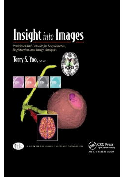 Insight into Images