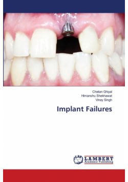 Implant Failures