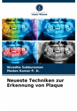 Neueste Techniken zur Erkennung von Plaque