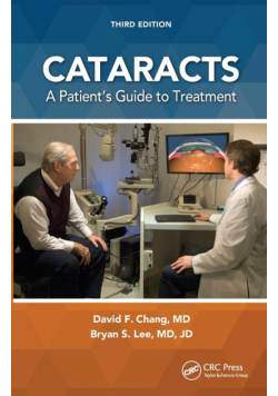 Cataracts