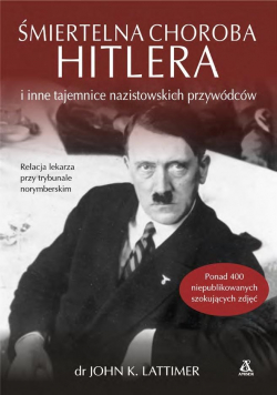 Śmiertelna choroba Hitlera i inne tajemnice..
