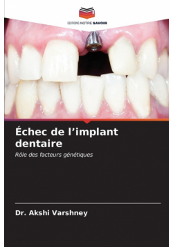 Échec de l'implant dentaire
