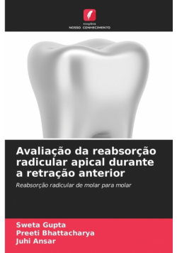 Avaliação da reabsorção radicular apical durante a retração anterior
