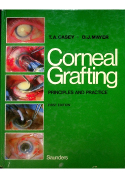 Corneal Grafting: Principles and Practice