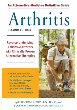 An Alternative Medicine Guide to Arthritis