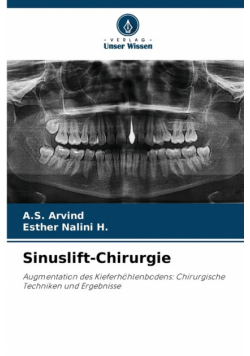 Sinuslift-Chirurgie