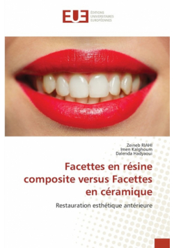 Facettes en résine composite versus Facettes en céramique