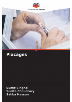 Placages