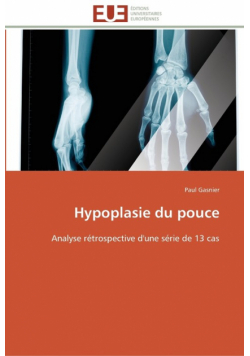 Hypoplasie du pouce
