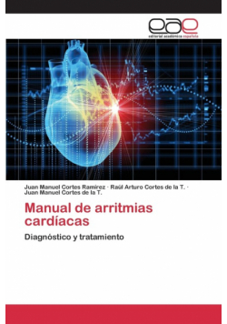 Manual de arritmias cardíacas