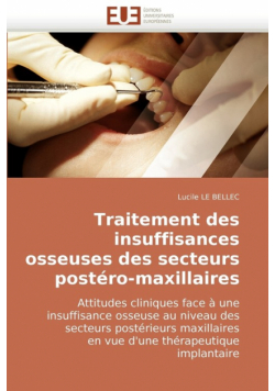 Traitement Des Insuffisances Osseuses Des Secteurs Postero-Maxillaires