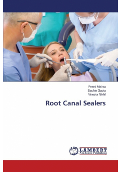 Root Canal Sealers