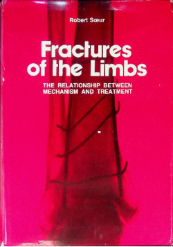 Fractures of the Limbs. The relationship between mechanism and treatment.