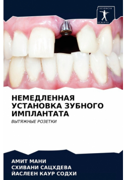 НЕМЕДЛЕННАЯ УСТАНОВКА ЗУБНОГО ИМПЛАНТАТА