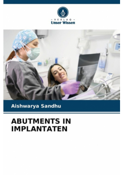 Abutments In Implantaten