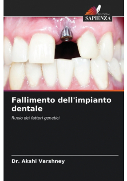 Fallimento dell'impianto dentale