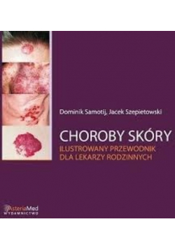 Choroby skóry ilustrowany przewodnik dla lekarzy