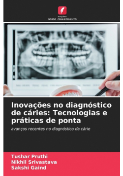 Inovações no diagnóstico de cáries