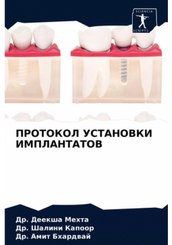 ПРОТОКОЛ УСТАНОВКИ ИМПЛАНТАТОВ