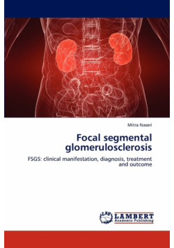 Focal segmental glomerulosclerosis