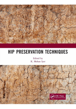 Hip Preservation Techniques