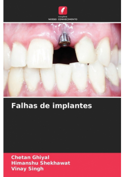 Falhas de implantes