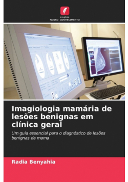 Imagiologia mamária de lesões benignas em clínica geral