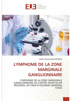 Lymphome De La Zone Marginale Ganglionnaire