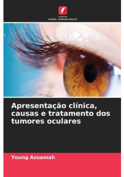 Apresentação clínica, causas e tratamento dos tumores oculares