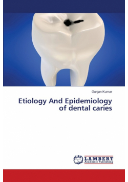 Etiology And Epidemiology of dental caries