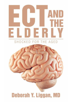 Ect And The Elderly