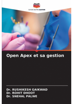 Open Apex et sa gestion