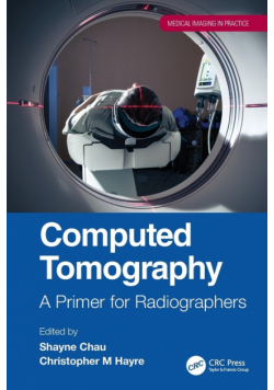 Computed Tomography