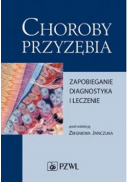 Choroby przyzębia Zapobieganie diagnostyka i leczenie