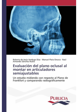 Evaluación del plano oclusal al montar en articuladores semiajustables