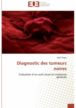 Diagnostic des tumeurs noires